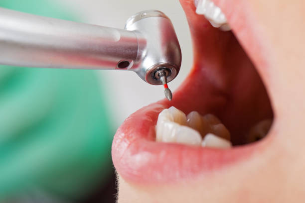 Best Broken or Cracked Tooth Emergency Dentist in Valley Stream, NY